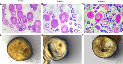 Synergistic Combination of Exogenous Hormones to Improve the Spawning and Post-spawning Survival of Female Yellow Catfish